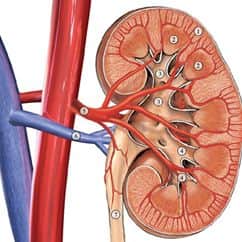 אבנים בכליות KIDNEY STONES